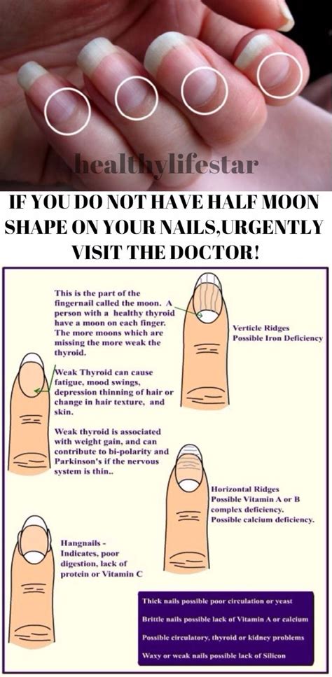 Visible Half Moons In nails means healthy thyroid..... | Healthy thyroid, Nail health, Thyroid