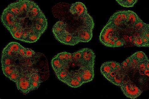 Making lab-grown brain organoids 'brainier' | Mirage News