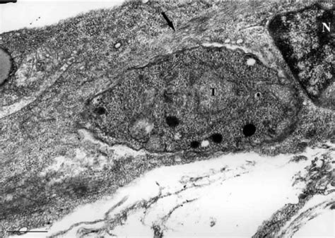 tachyzoites of Toxoplasma gondii and skeletal muscle cell seen by... | Download Scientific Diagram