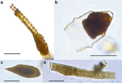 4 Examples of heterotrophic protist morphotypes observed in western... | Download Scientific Diagram