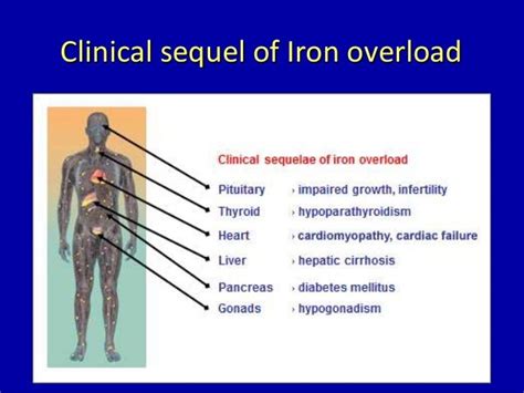 Iron toxicity