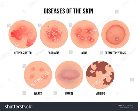 Skin Disease Types Dermatology Problems Names Stock Vector (Royalty ...