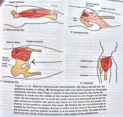 #Pharmacology #injection sites for intramuscular administration ...