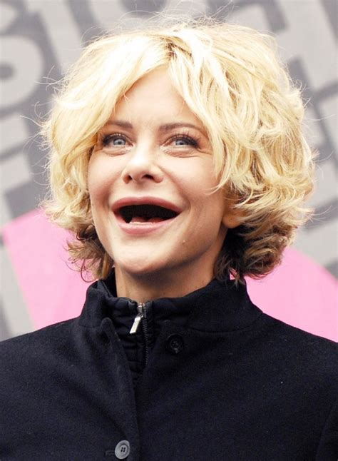 Meg Ryan plastic surgery (7) – Celebrity plastic surgery online