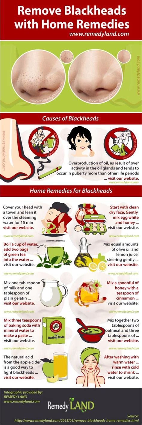 Remove Blackheads with Home Remedies - Remedy Land