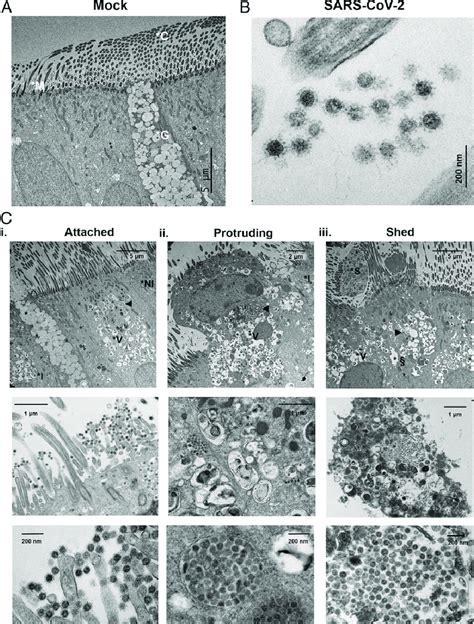 Three cytopathologic stages of SARS-CoV-2-infected ciliated cells. (A)... | Download Scientific ...