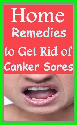 Home Remedies to Get Rid of Canker Sores - Handy DIY