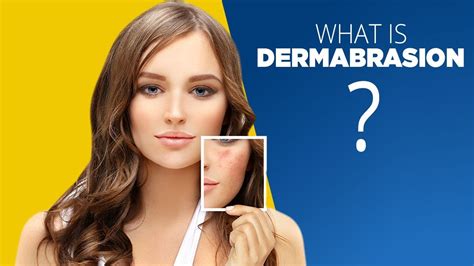 What is Dermabrasion good for | Side Effects and More - YouTube