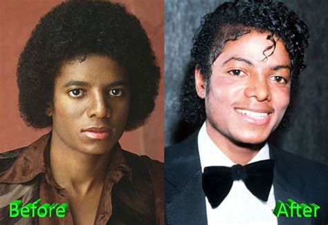 The Unforgettable Michael Jackson Before and After Plastic Surgery Pictures | Lazana