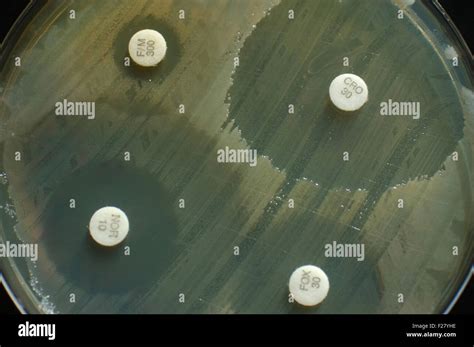 petri dish with antibiotic sensitivity discs showing inhibition zones Stock Photo: 87456474 - Alamy