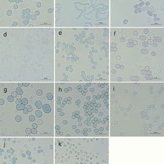 (PDF) Discrimination Between Synechocystis Members (Cyanobacteria ...