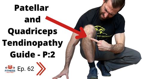 Patellar and Quadriceps Tendinopathy: Evidence Based Guide – Diagnosis, Differential Diagnosis ...