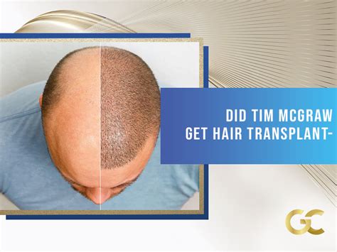 DİD TİM MCGRAW GET HAIR TRANSPLANT? - Acıbadem Best Hair Transplant Turkey