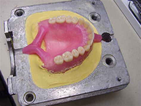 Archivo:Making of complete denture 04.JPG - Wikipedia, la enciclopedia libre
