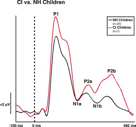 Visual Evoked Potential (VEP) Pattern B in Normal hearing (NH) and... | Download Scientific Diagram