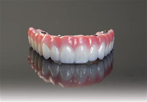 BruxZir® Solid Zirconia Surpasses Five Years of Clinical Use