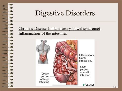 Digestive Disorders | Transforming Health