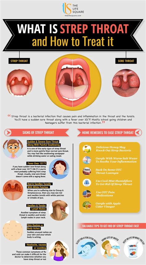 6 Warning Signs Of Strep Throat - Ultimate Guide | Strep throat, Signs of strep throat, Dry ...