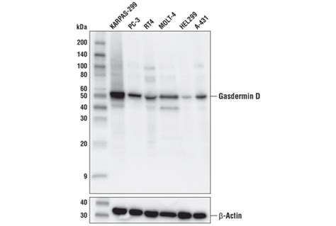 Gasdermin D Antibody | Cell Signaling Technology