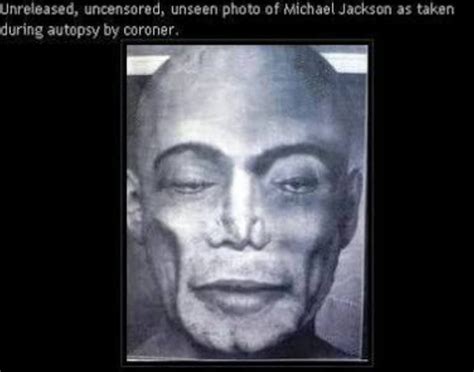 Michael Jackson Autopsy Report