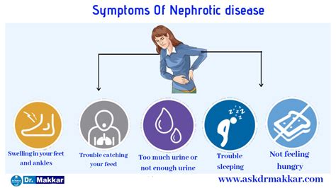 Nephrotic Syndrome - Homeopathic Medicines & Treatment By Dr Makkar India Punjab