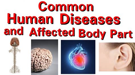 Common Human Diseases and Affected Body Part - YouTube