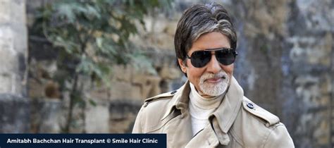 Amitabh Bachchan Hair Transplant - Smile Hair Clinic