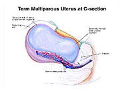 Cesarean Section Medical and Trial Exhibits