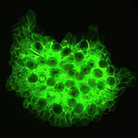 Image: Fluorescent Stain (Pneumocystis jirovecii) - MSD Manual ...