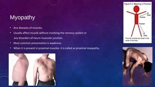 Proximal myopathy and causes | PPT