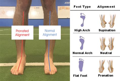 Corrective Exercise for foot and ankle | Knee tendonitis, Exercise, Gluteus medius