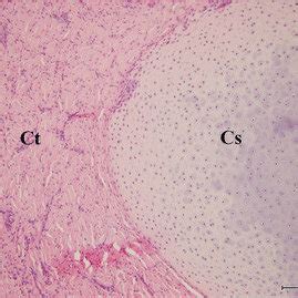 Histology of the nasal tissue-derived hamartoma. The cartilage-like... | Download Scientific Diagram