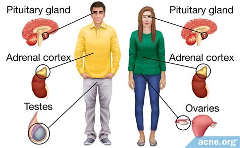 Hormones and Acne - Testosterone and Estrogen - Acne.org