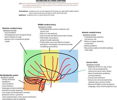 78 Amazing What Are The Symptoms Of A Lacunar Stroke - insectza