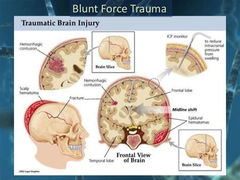 Brain damage symptoms causes treatments – Artofit