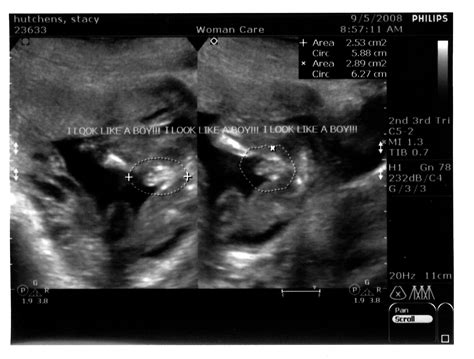 My Messy Manger: 18 Weeks and Ultrasound Pics