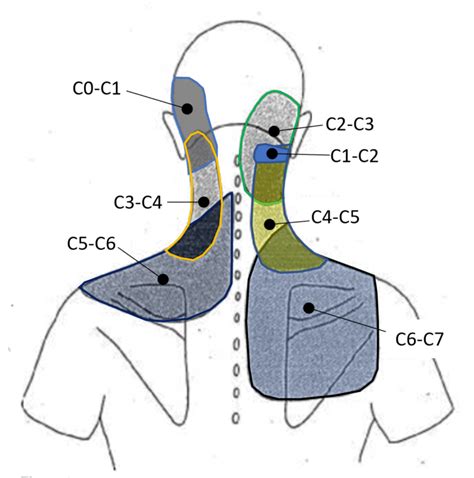 What's the Purpose of a Neck Facet Injection? - Regenexx