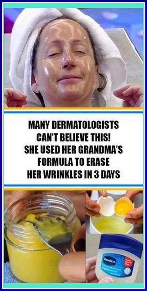 DERMATOLOGISTS CAN’T BELIEVE THIS SHE USED HER GRANDMAS FORMULA TO ...