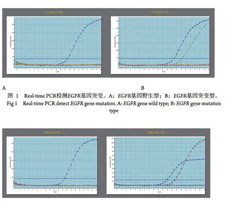 Real-time PCR detect KRAS gene mutation. A: KRAS gene wild type; B ...