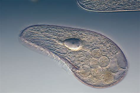 Protozoa ~ Everything You Need to Know with Photos | Videos