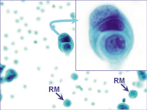 The panorama of different faces of mesothelial cells - CytoJournal