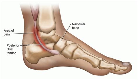 Foot & Ankle Pain - Elite Podiatry