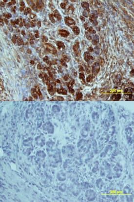 Human Glut2 Antibody MAB1414: R&D Systems