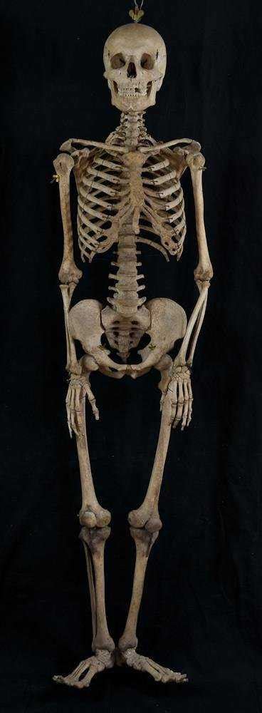 Antique human medical skeleton