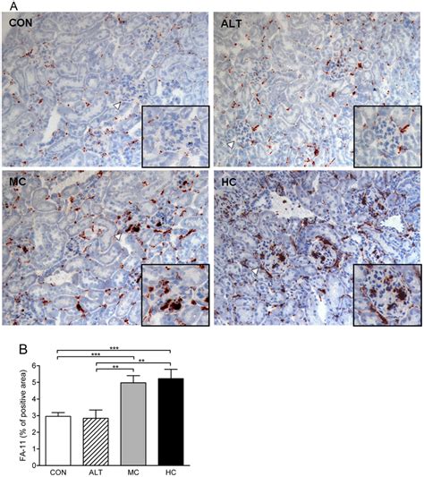 Immunohistochemistry for macrophages (CD68) in the kidney. A)... | Download Scientific Diagram