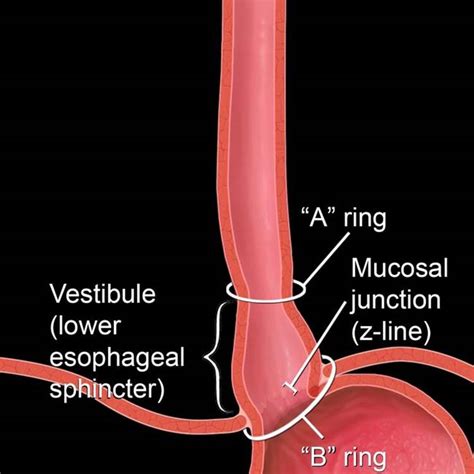 [DIAGRAM] Diagram Of The Lower Esophageal Sphincter - MYDIAGRAM.ONLINE