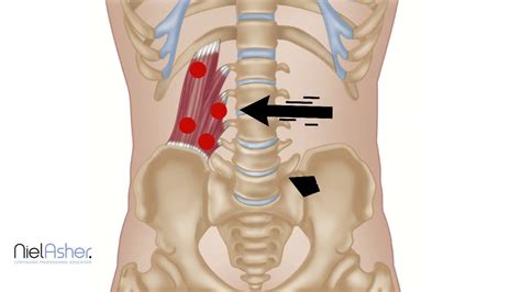 Quadratus Lumborum - Trigger Point Anatomy - YouTube