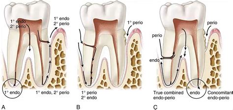 Rimu Endo – Telegraph