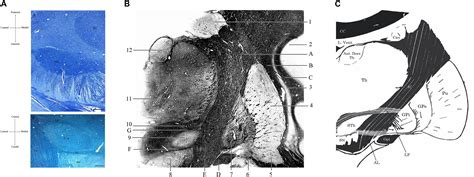 Frontiers | Anatomy and Connectivity of the Subthalamic Nucleus in ...