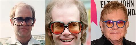 From Transplants to Wigs: Is Elton John Bald? - Hair System